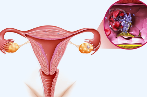 巧囊做試管的影響並不大