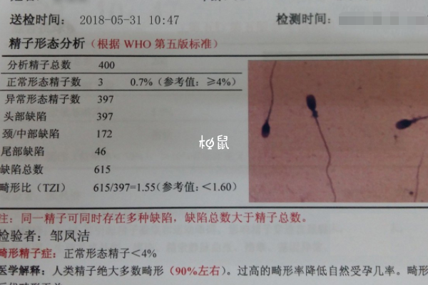 精子不液化治疗后试管成功率高