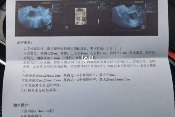卵泡監測沒有時間限制