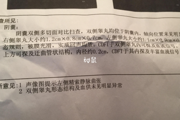 精索静脉曲张能做试管