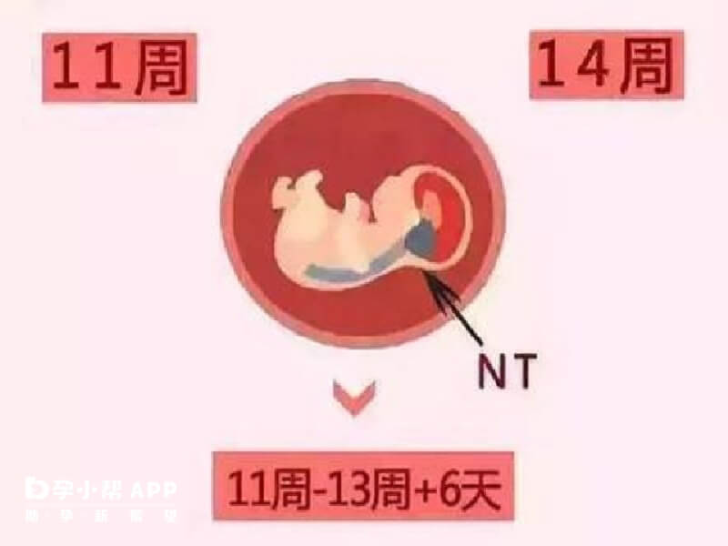 nt检查的报销分四步