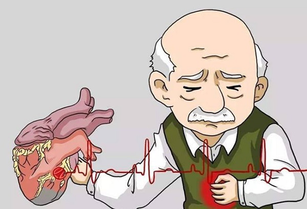 心絞痛可吃硝苯地平片進行緩解