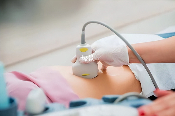 卵泡監測上午或者下午做都可以