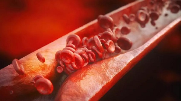 預防血栓形成可吃拜阿司匹林