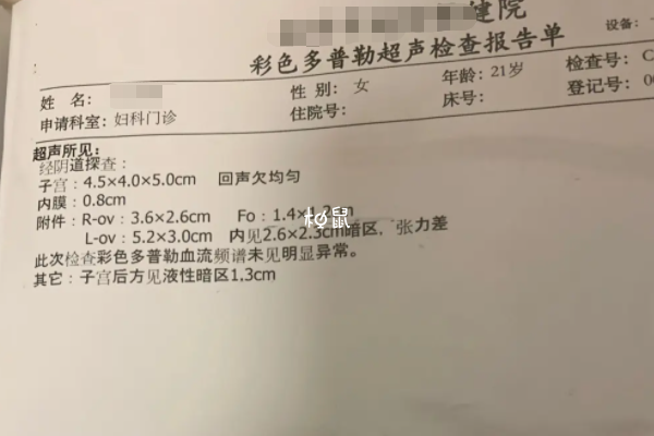 监测卵泡也有一些注意事项