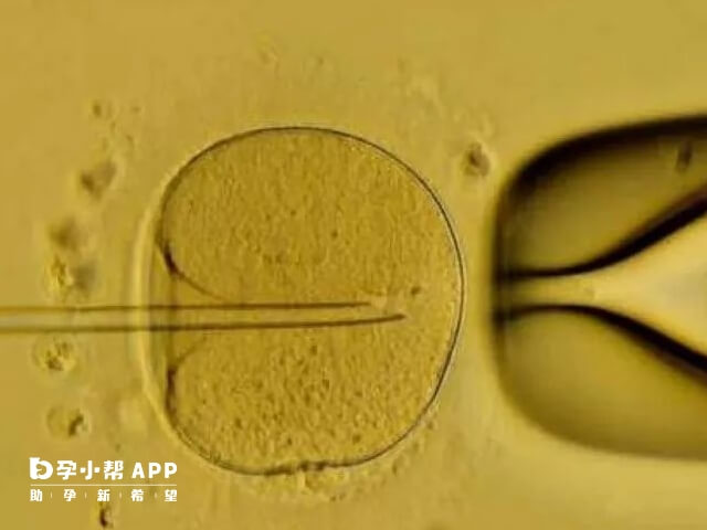 試管嬰兒技術高階複雜