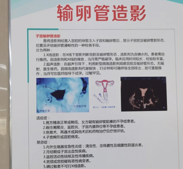 輸卵管造影會影響到月經