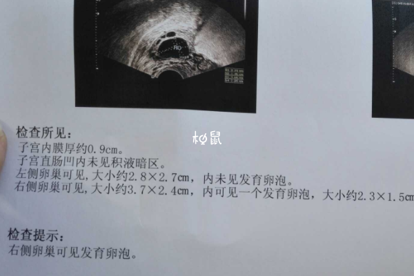 监测卵泡报告数字能看发育情况