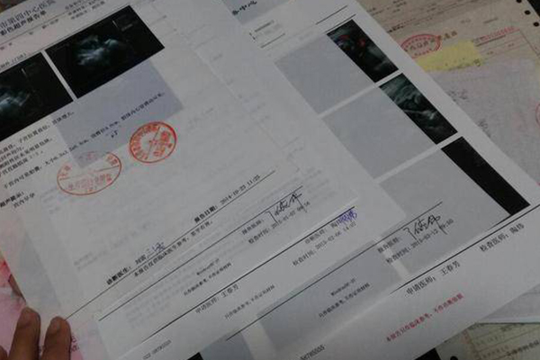 产检花费需个人先垫付