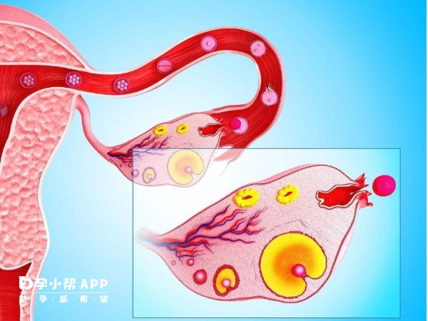 卵巢早衰會導致不孕