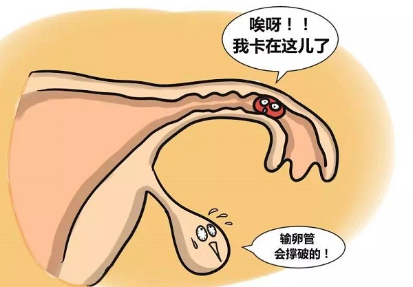 不當使用孕康口服液會引起副作用