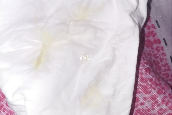 孕期正常分泌物图片