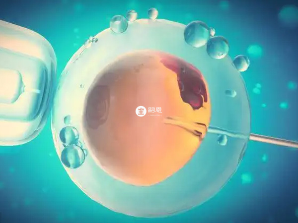 試管嬰兒技術分為三代