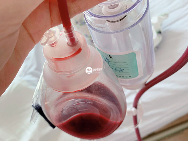 巧囊一般很難自行消失