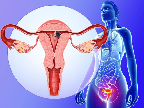 環境汙染會造成子宮畸形