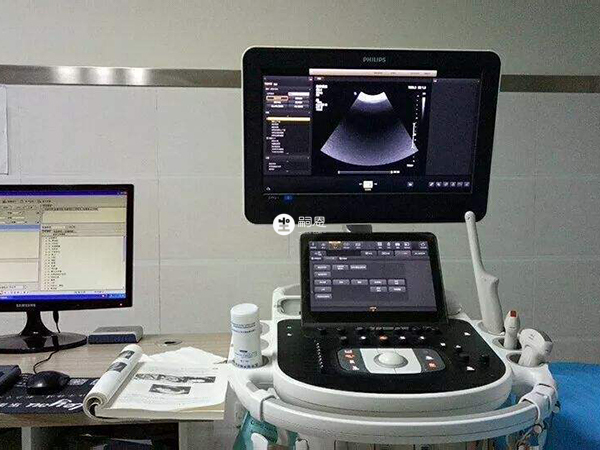 超聲波檢查在任何時候都可以