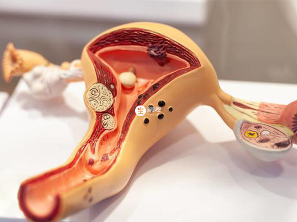 子宮切除最主要的是無法生育