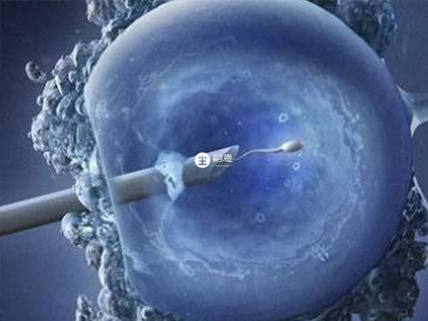 不孕不育的患者可以在臺灣進行試管嬰兒手術