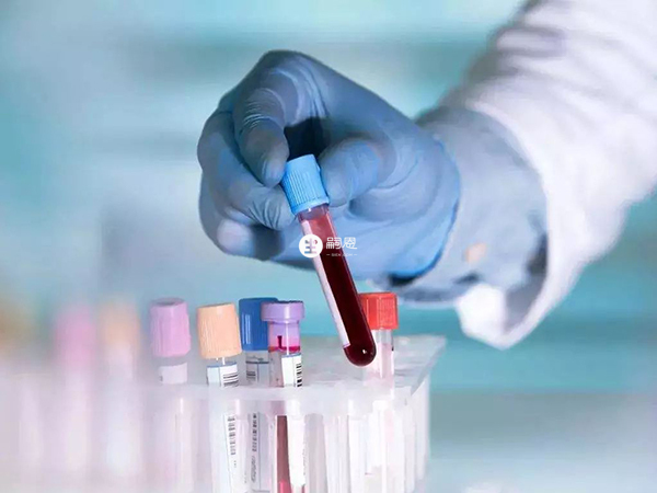 內分泌檢查幫助患者更好的瞭解精子功能