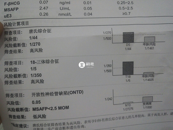 唐氏筛查是“唐氏综合症产前筛选检查”的简称