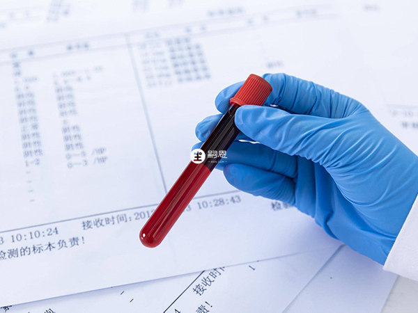 做唐氏筛查需要抽血