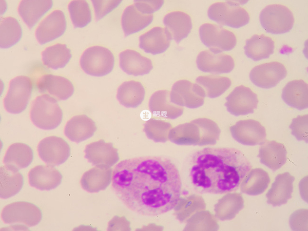 惠爾血可以加速中性粒細胞的恢復