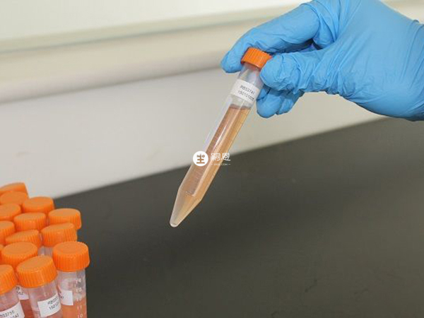 酶联免疫分析法更灵敏快速