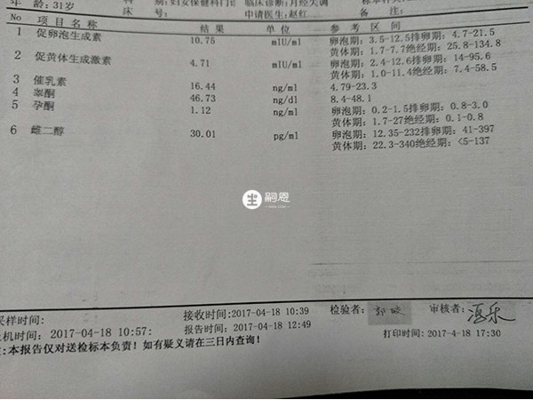 性激素六项可了解女性内分泌的情况
