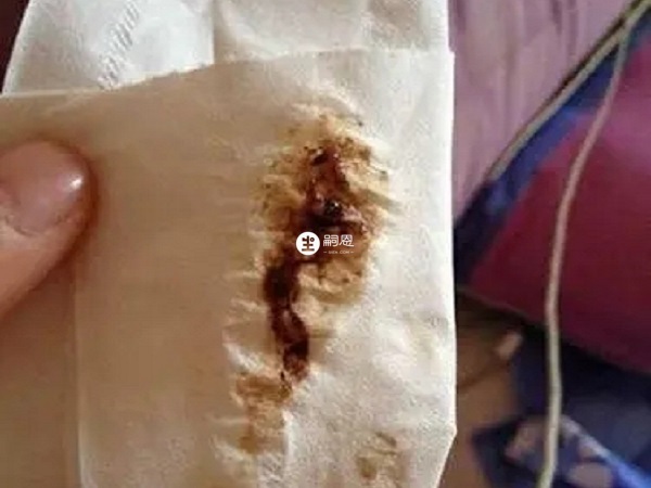 孕早期褐色分泌物可能是宮外孕