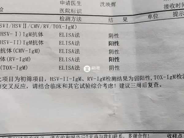igg抗体的数值并不是越高越好