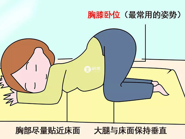 膝胸臥位糾正臀位