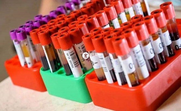 抗繆勒氏管激素檢查