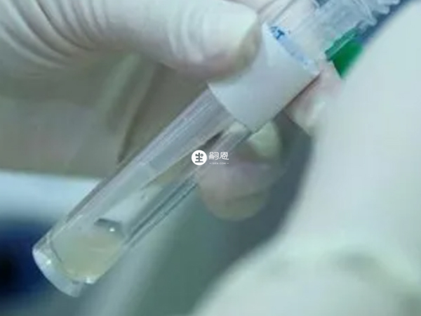 國內沒有醫院給男性HIV洗精