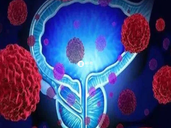 諾雷得主要用於前列腺癌的治療