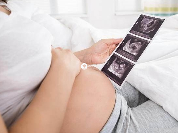 胎位異常是不能用催產素的