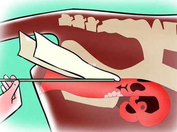 人工授精部位有宮腔、陰道、輸卵管等