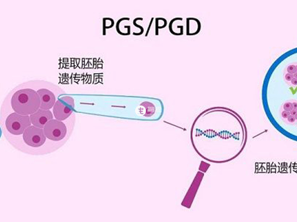 第三代试管又叫胚胎植入前遗传学诊断