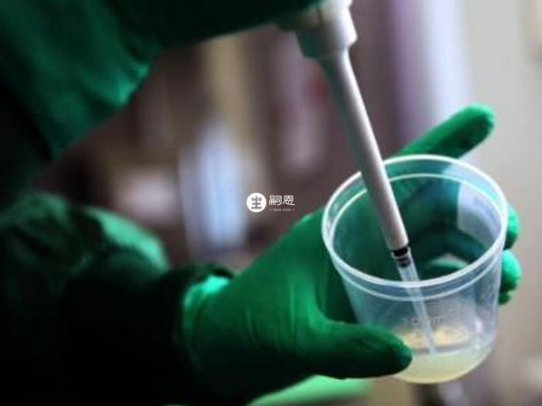 患有hiv病毒的患者洗精做试管婴儿