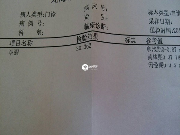 孕酮检测报告单