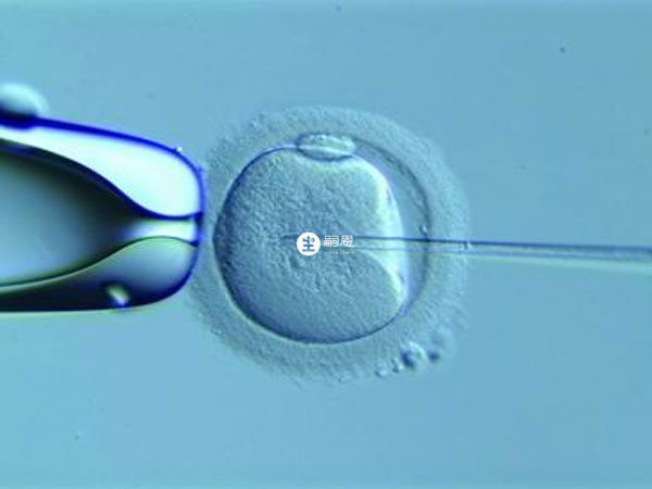 試管嬰兒選擇方案因人而異