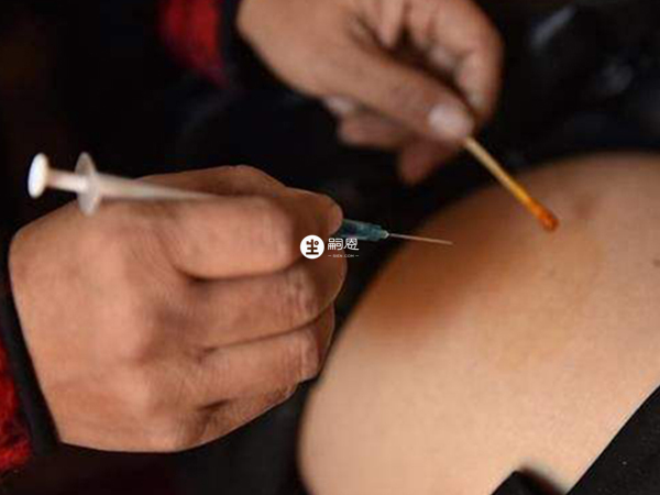 注射樂寶得促排卵針要找準部位