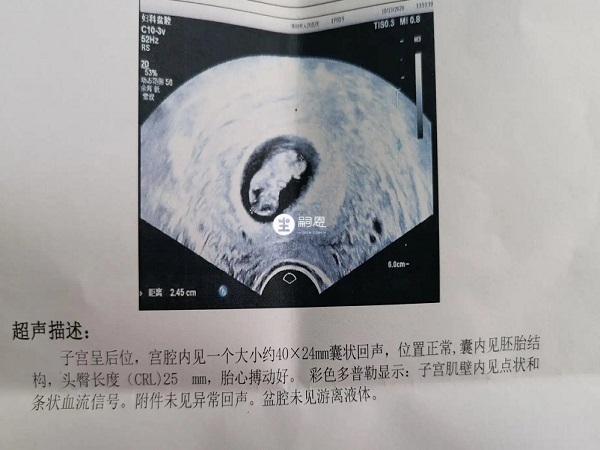 胎心胎芽一般在孕50天后出現