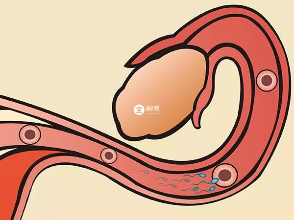 成熟卵泡直徑有20mm