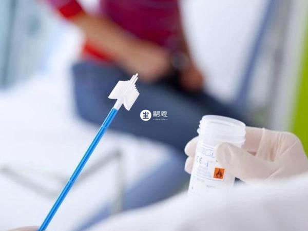 試管嬰兒前有必要做tct檢查