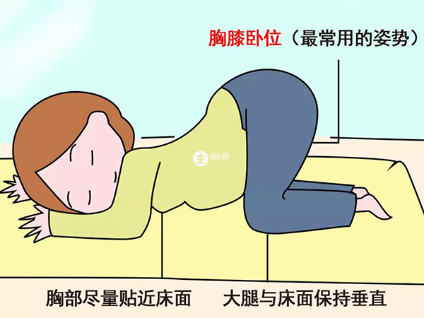 胎位不正可以做膝胸臥位操