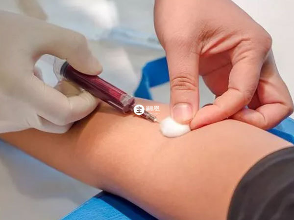 乙肝做試管前是必要檢查之一