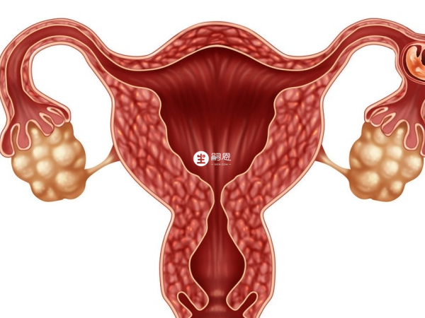 巧囊懷孕需要保胎