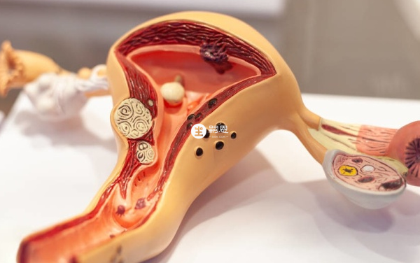 巧囊可手術治療