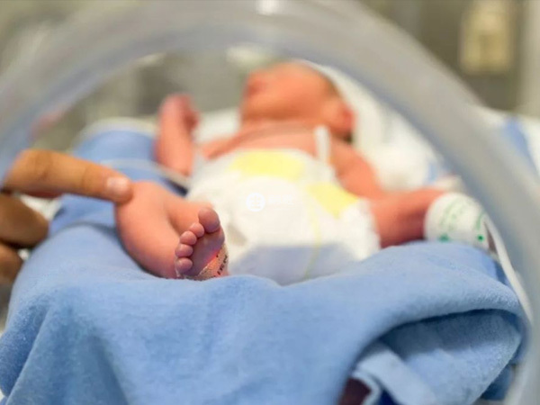 生理性新生兒黃疸會自行消退