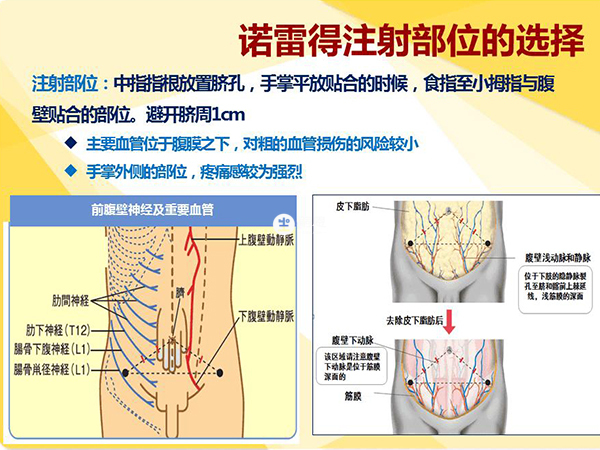 诺雷得正确注射部位